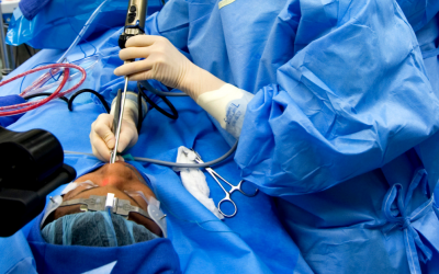 Special Rules Apply to Endoscopic Sinus Surgeries